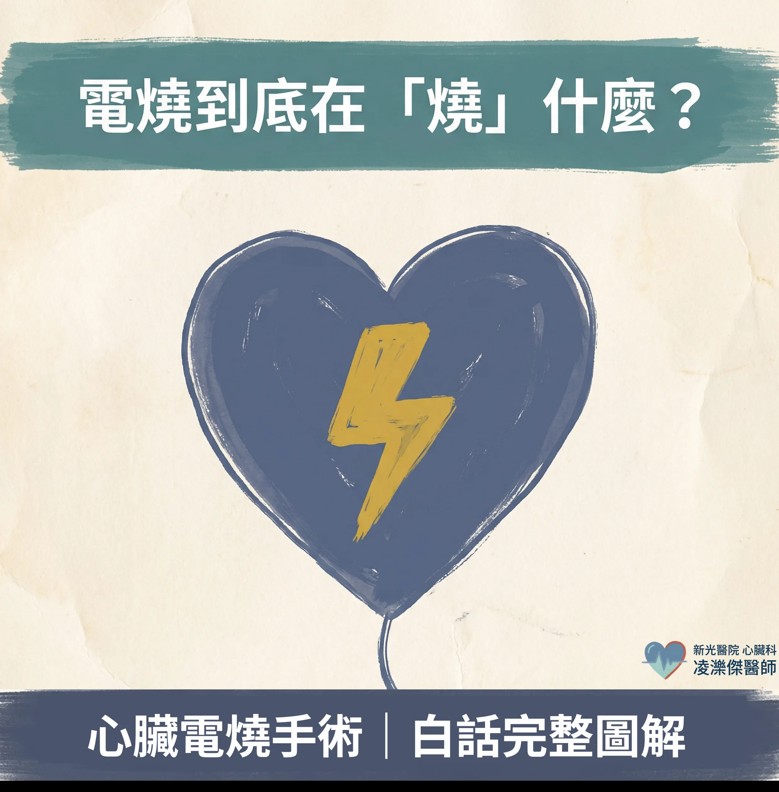 電燒是什麼?心臟導管電燒到底在「燒」什麼,白話解說 圖卡 1