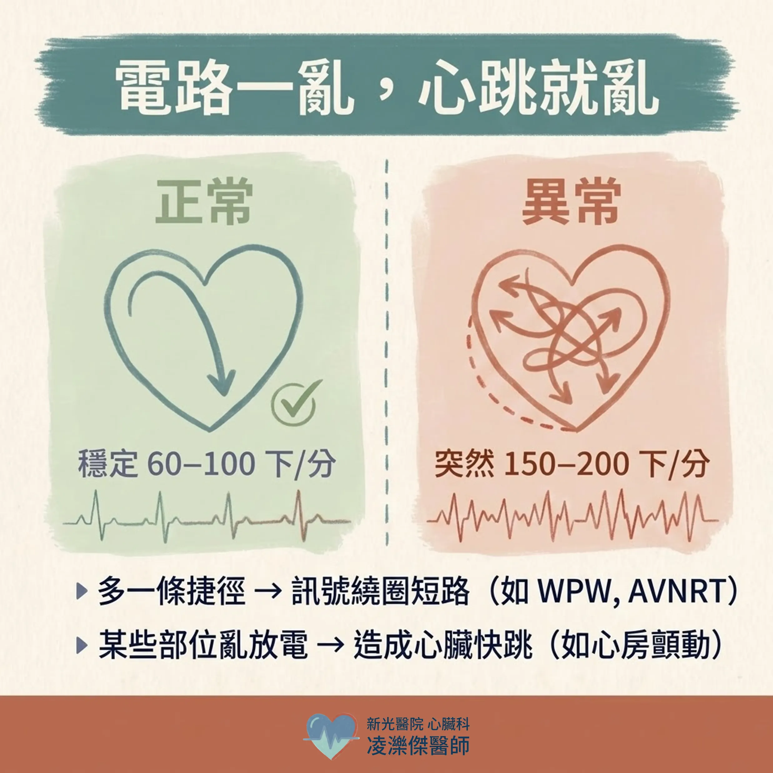 電燒是什麼?心臟導管電燒到底在「燒」什麼,白話解說 圖卡 3