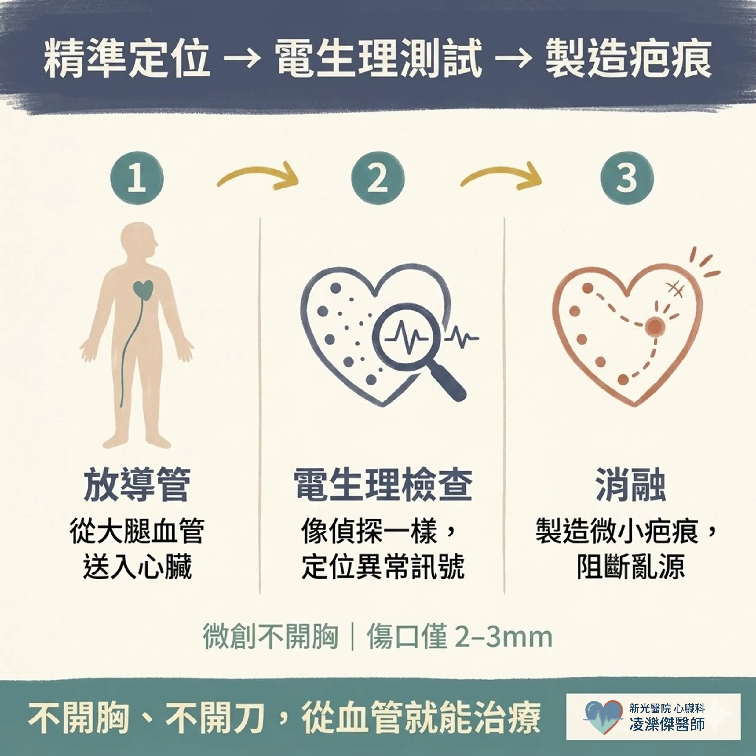 電燒是什麼?心臟導管電燒到底在「燒」什麼,白話解說 圖卡 4