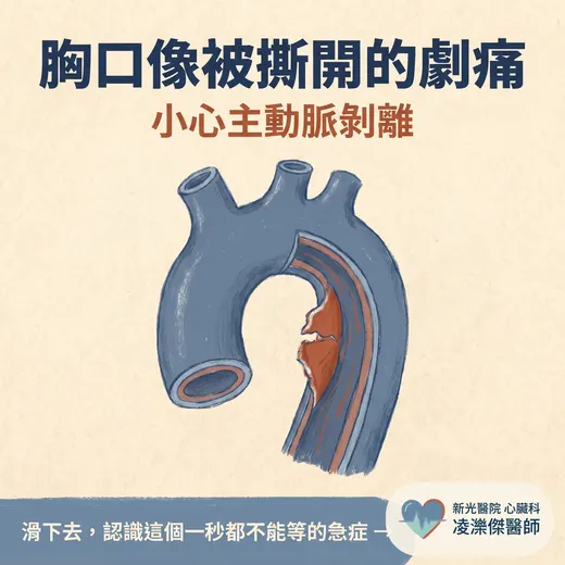 主動脈剝離：突然撕裂般的劇烈胸痛，一秒都不能等