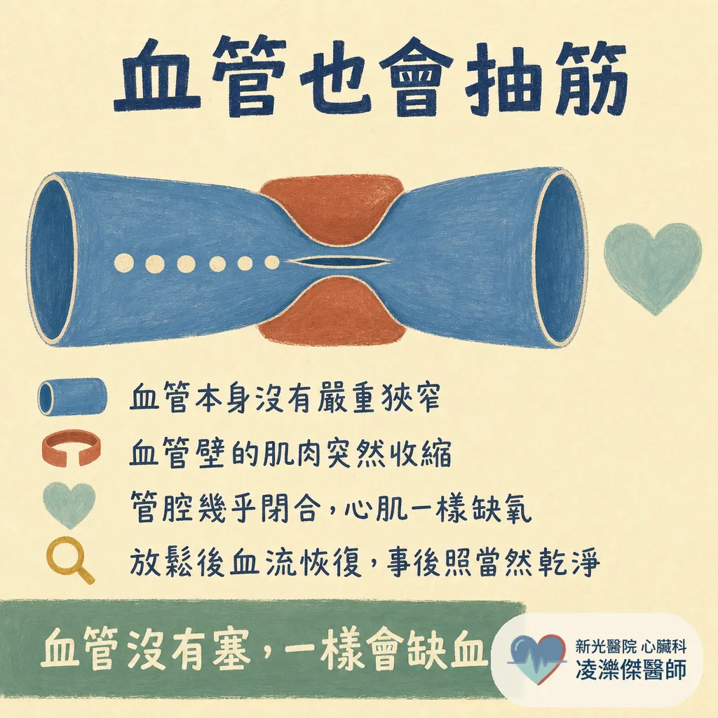 血管沒塞,為什麼還是胸痛?認識冠狀動脈痙攣(血管痙攣型心絞痛) 圖卡 2