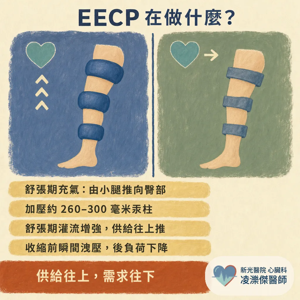 EECP(增強型體外反搏)是什麼?能不能取代支架?心臟科醫師談它幫得上什麼忙 圖卡 2