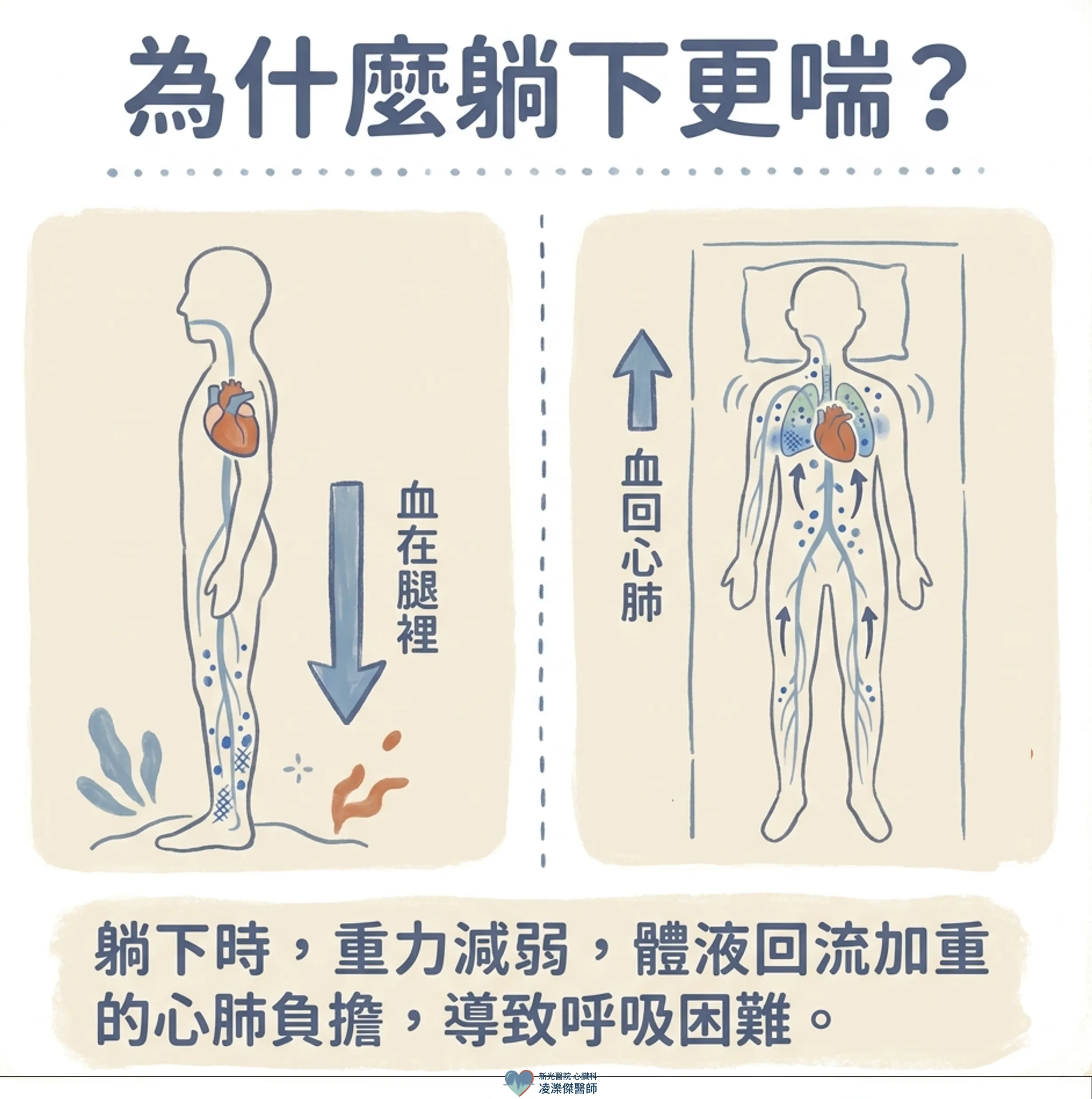 走幾步就喘、躺下更喘:心衰竭在提醒什麼? 圖卡 3