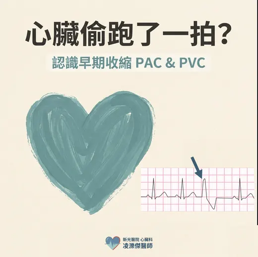 心臟偷跑了一拍：早期收縮（PAC/PVC）要治療嗎？