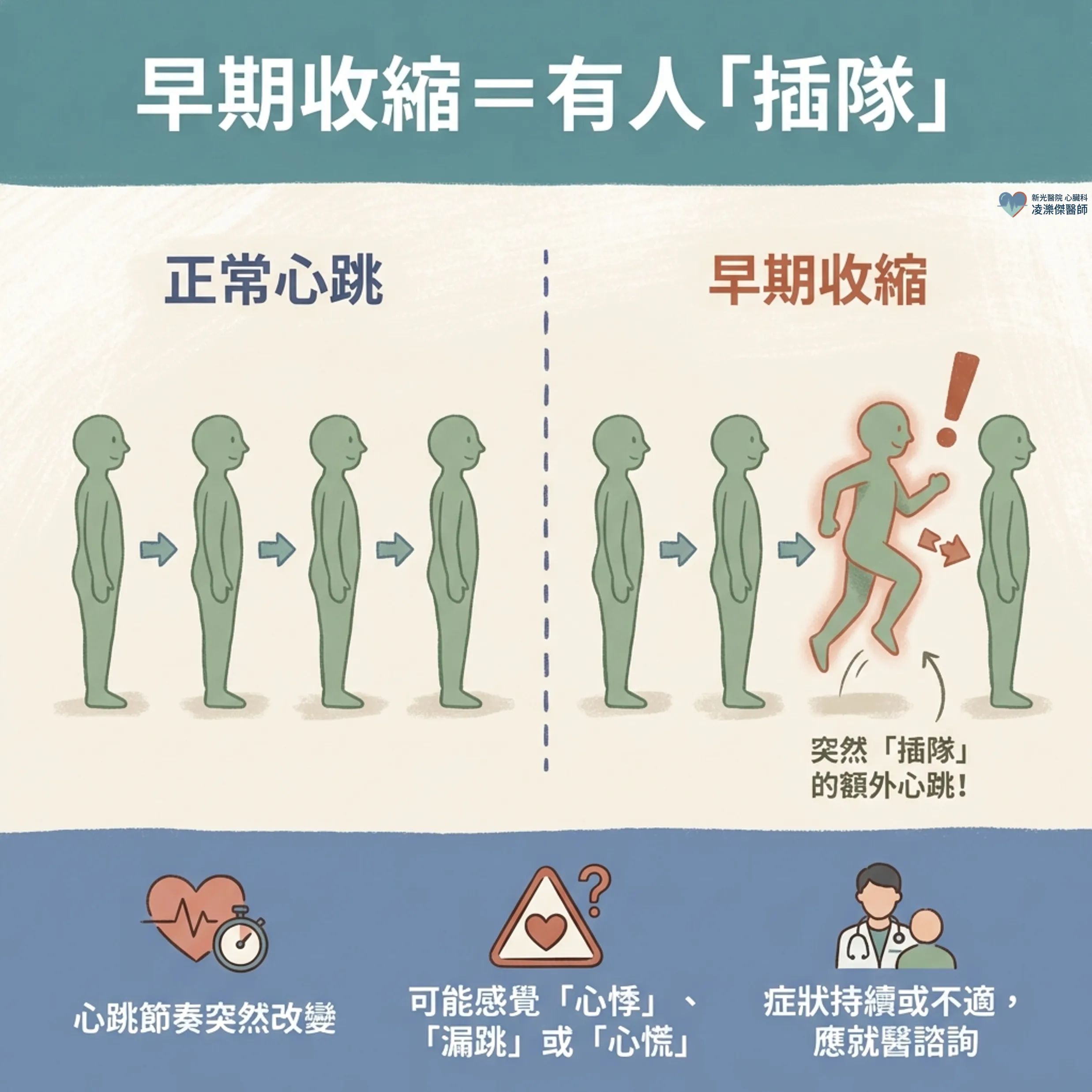 PAC/PVC 早期收縮是什麼?心臟偷跑、心跳漏拍要治療嗎 圖卡 2