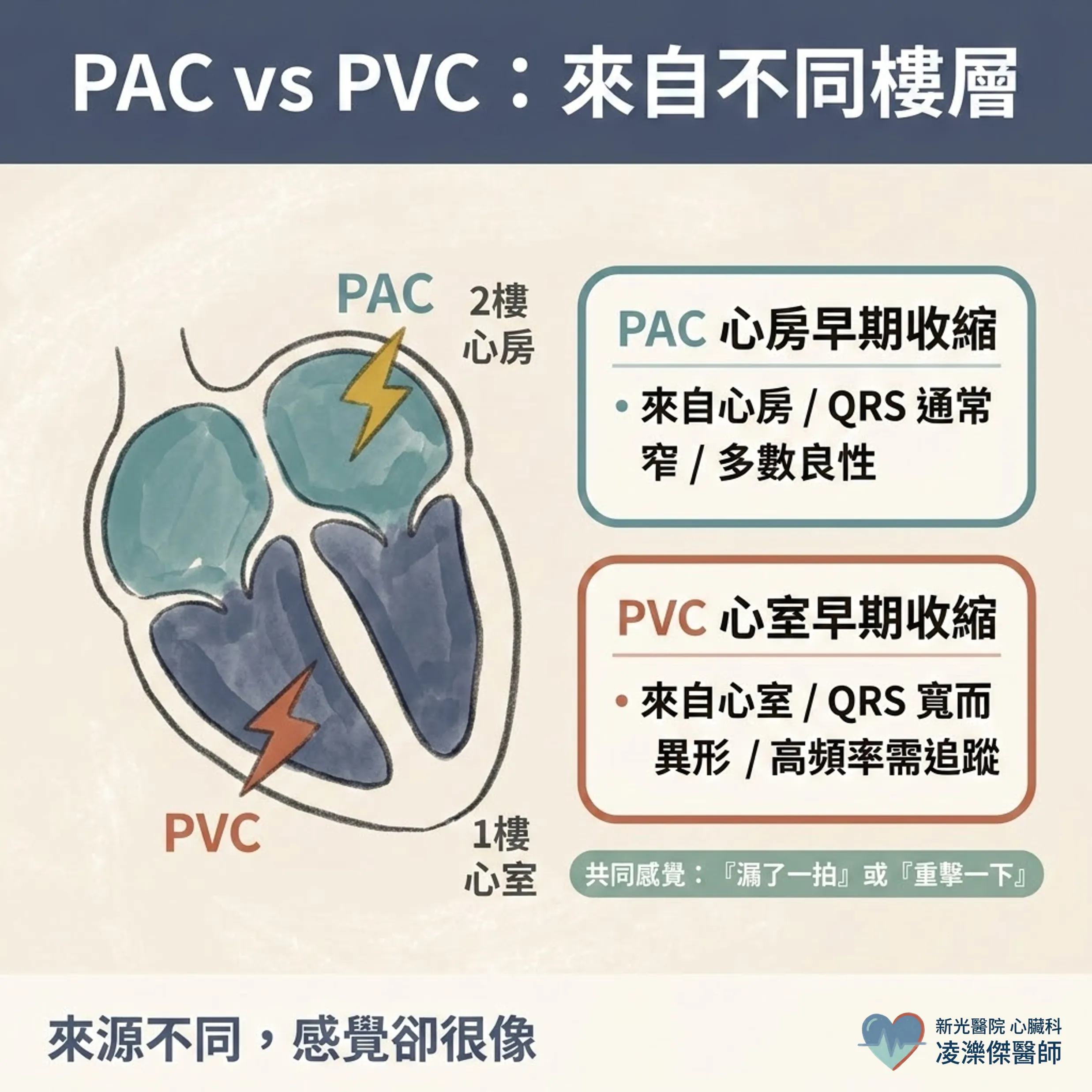 PAC/PVC 早期收縮是什麼?心臟偷跑、心跳漏拍要治療嗎 圖卡 3