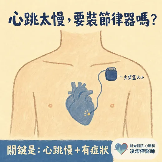 心臟節律器是什麼？心跳太慢就要裝嗎？手術過程與術後生活一次看懂