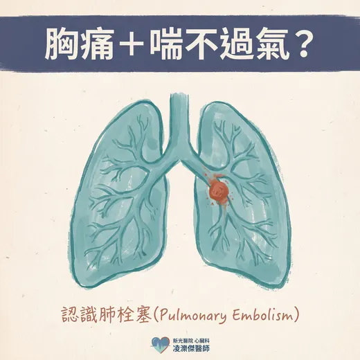 胸痛＋喘不過氣？小心肺栓塞