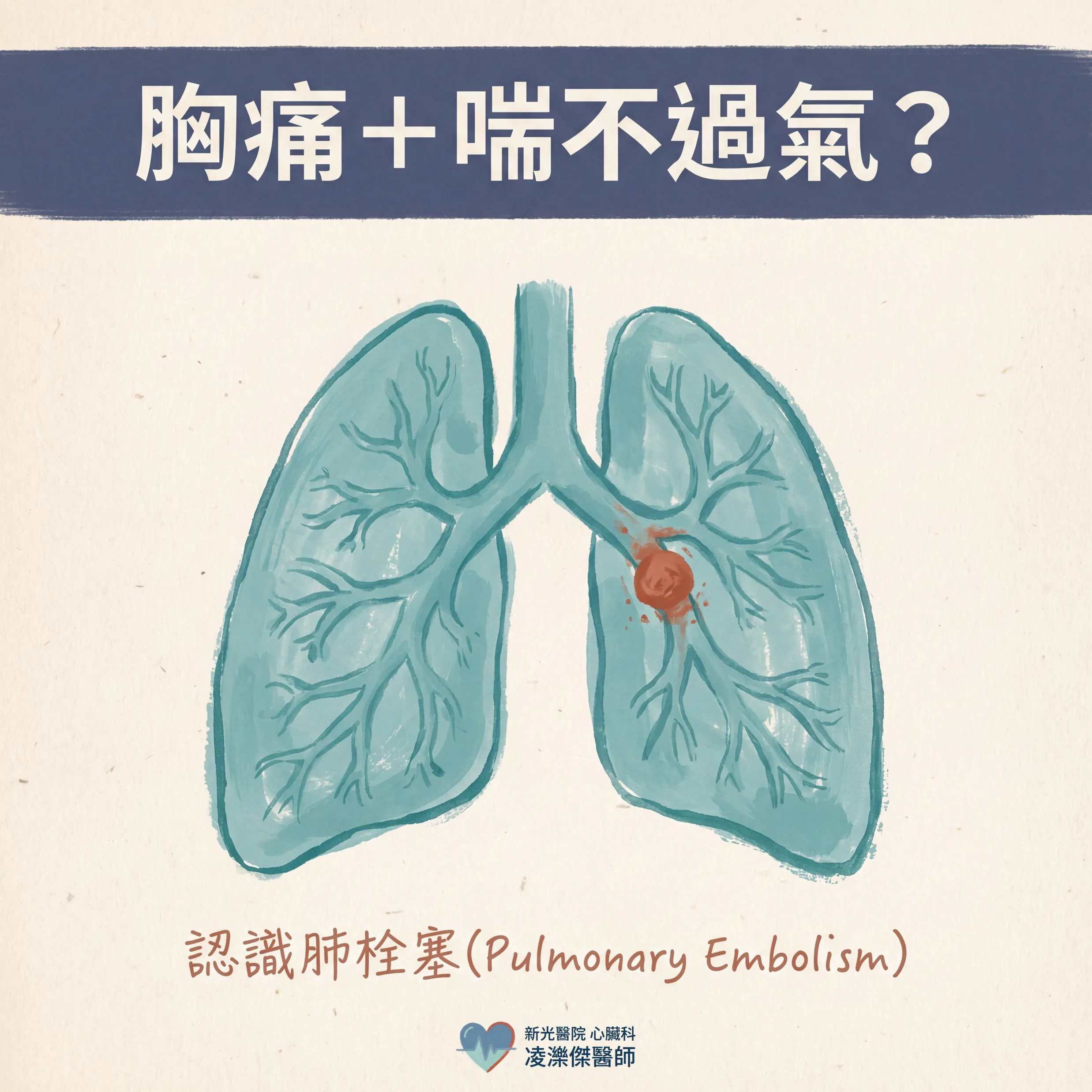 胸痛+喘不過氣?小心肺栓塞 圖卡 1