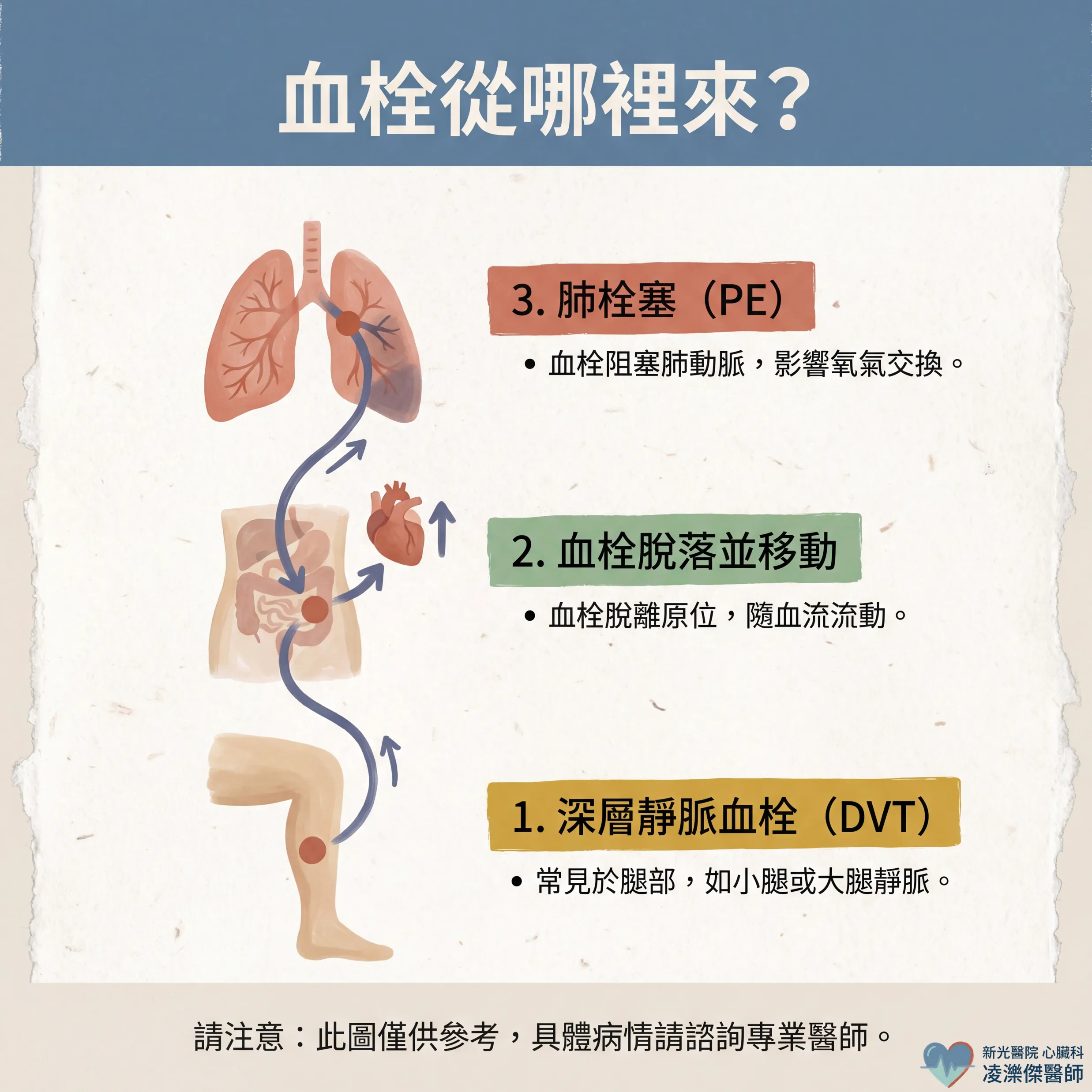 胸痛+喘不過氣?小心肺栓塞 圖卡 2