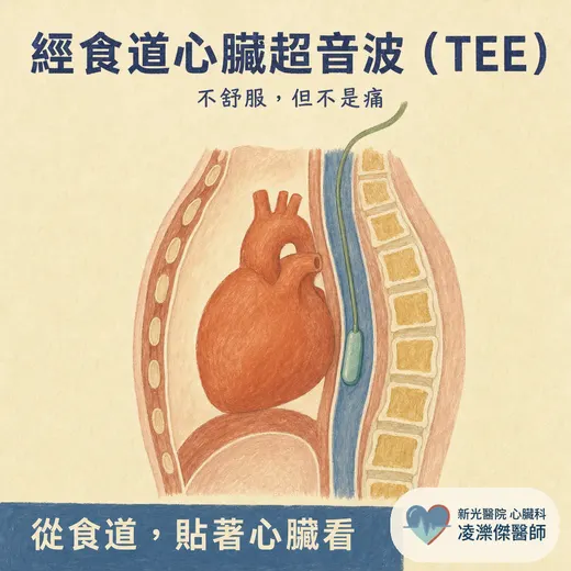 經食道心臟超音波（TEE）會不會很痛？在檢查什麼、流程與安全性一次說清楚