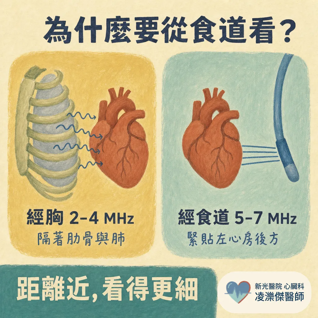 經食道心臟超音波（TEE）會不會很痛？在檢查什麼、流程與安全性一次說清楚 圖卡 2