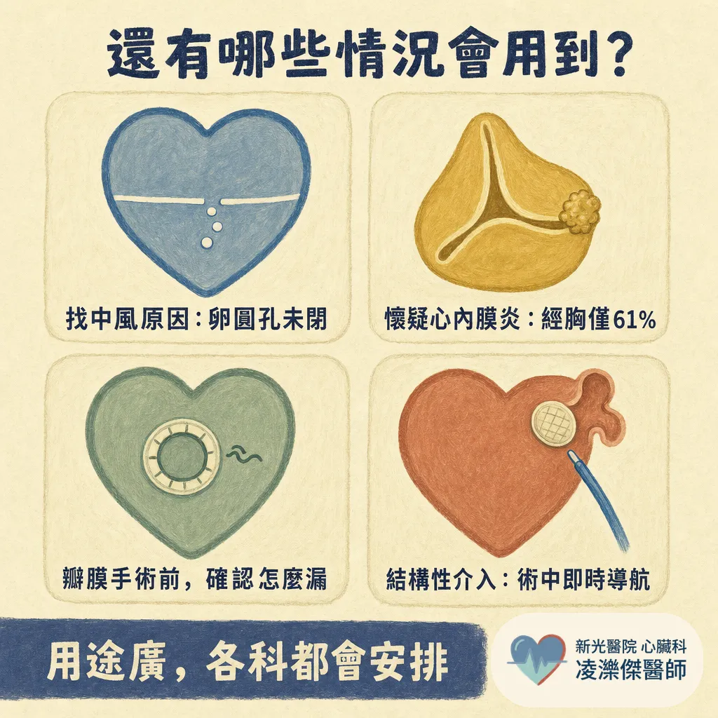 經食道心臟超音波(TEE)會不會很痛?在檢查什麼、流程與安全性一次說清楚 圖卡 4