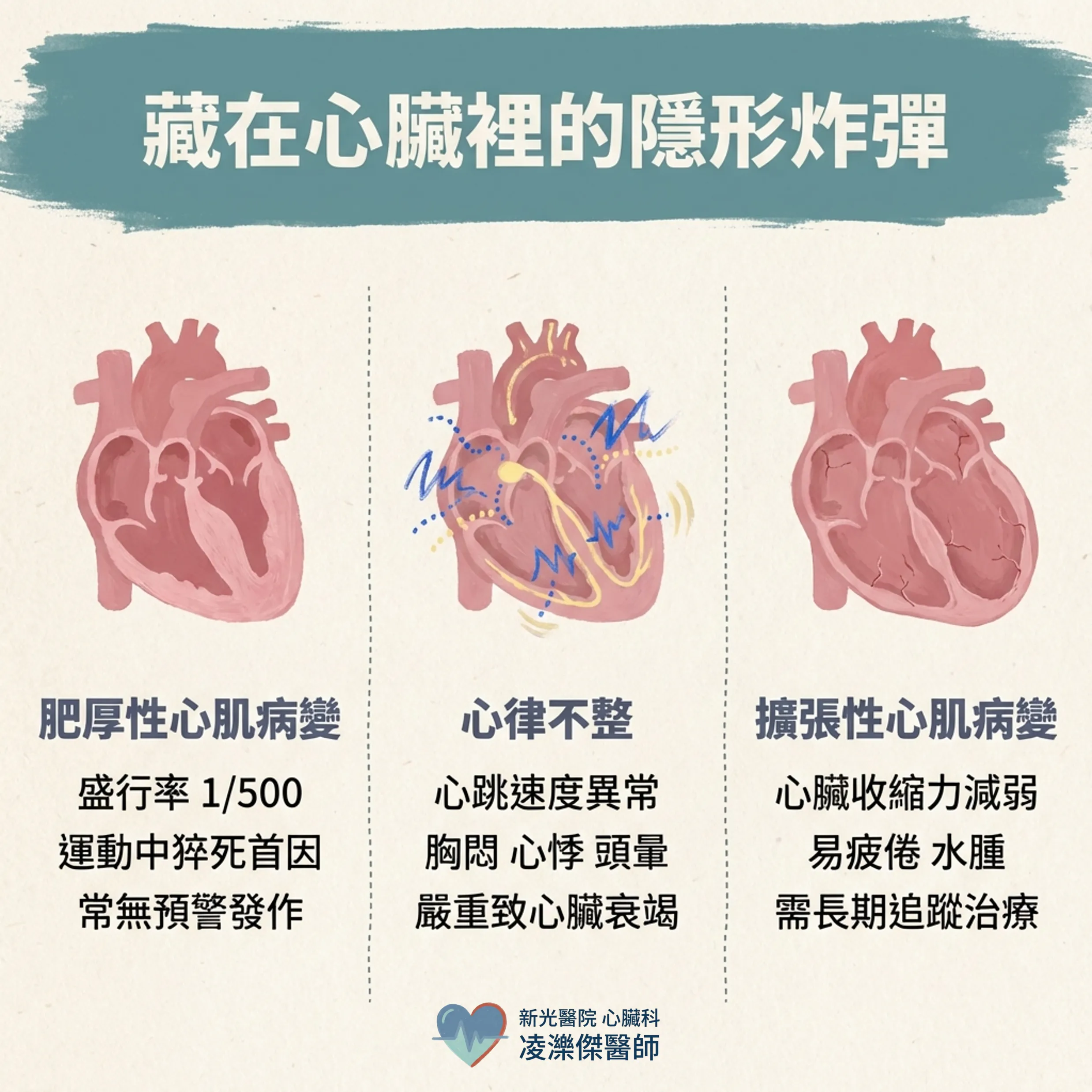 年輕人胸痛:哪些狀況不能只說「沒事」 圖卡 2